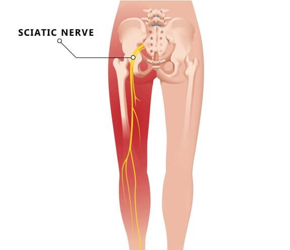 Why Are Todays Sore Hams So Dry？ Common Causes Explained